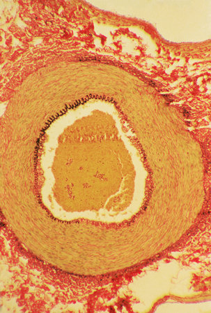 Blood vessel