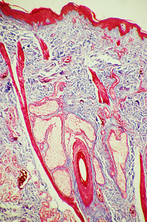 Hair follicle in skinの写真素材