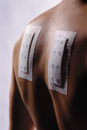 Allergy testの写真素材