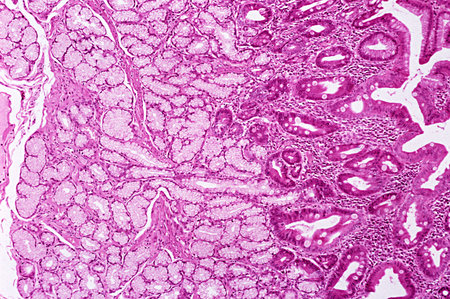 Brunner's glands in duodenum