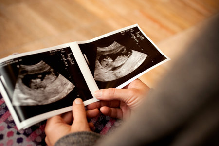 Woman Holding Ultrasound Scan Photograph