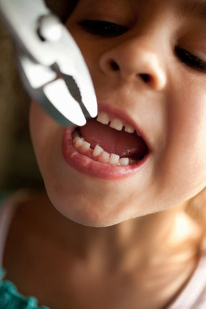 Girl Pulling Out Tooth With Pliersの写真素材