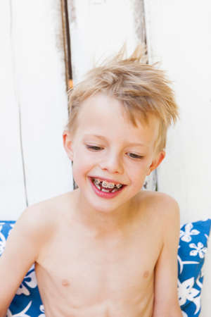 Close up of boy with braces smilingの写真素材