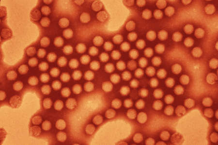 Electron micrograph of equine adenovirus