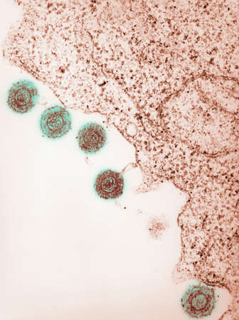 Electron micrograph of human herpes virus-6, HHV-6