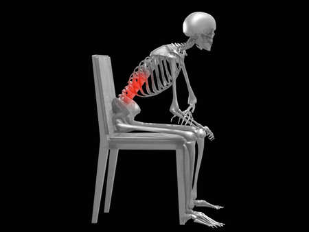 Low back pain illustrationの写真素材