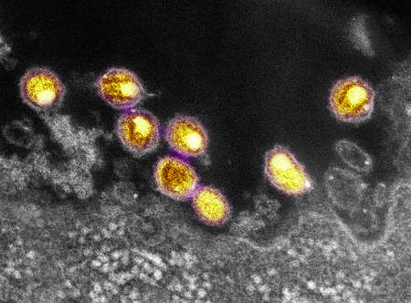 SEM of HIV virionsの写真素材