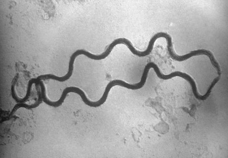 EM of two Treponema pallidum bacteria