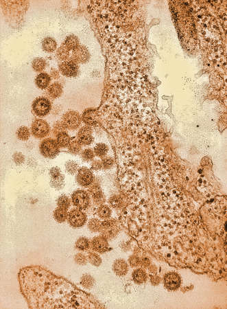 Electron photomicrograph of the Machupo Virus