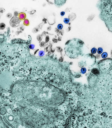 TEM of HTLV I and HIV viruses