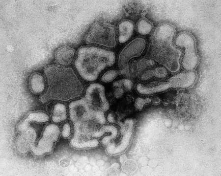 TEM, of the A/New Jersey/76, Hsw1N1, virus