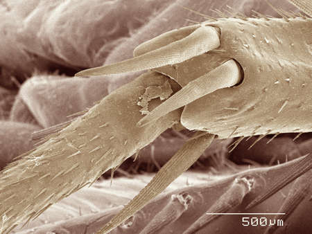 Coloured SEM of American cockroach leg