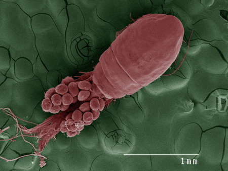 Coloured SEM of cyclops, overhead view