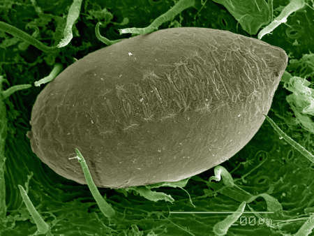 Egg of Psocid (Cerobasis sp.) on leaf surface