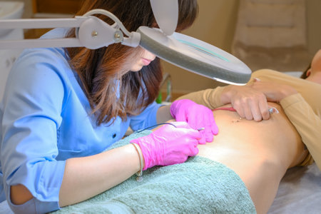 Young woman dermatologist doing hair removal treatment on patients bikini zone with electrolysisの写真素材