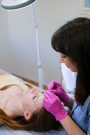 Young woman dermatologist doing hair removal treatment on patients face with electrolysisの写真素材