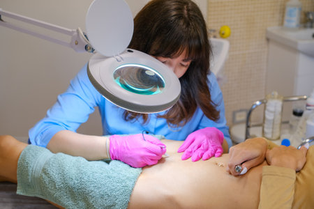 Young woman dermatologist doing hair removal treatment on patients bikini zone with electrolysisの写真素材
