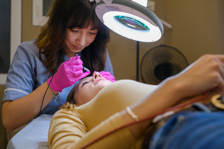 Young woman dermatologist doing hair removal treatment on patients face with electrolysisの写真素材