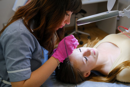 Young woman dermatologist doing hair removal treatment on patients face with electrolysisの写真素材