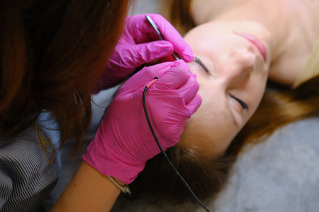Young woman dermatologist doing hair removal treatment on patients face with electrolysisの写真素材