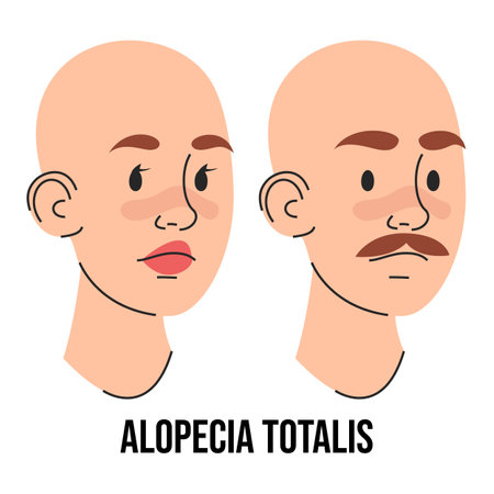 Alopecia totalis vector isolated. Male and female character suffering from hair loss. Completely bald head. Medical condition. Baldness, scalp disease.のイラスト素材