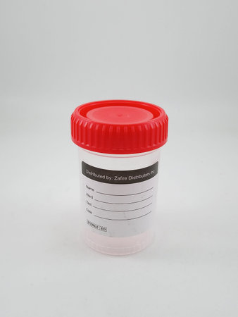 MANILA, PH - OCT 27 - Urine sample container on October 27, 2020 in Manila, Philippines.