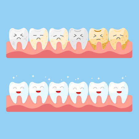 Teeth cartoon clean and dirtyのイラスト素材