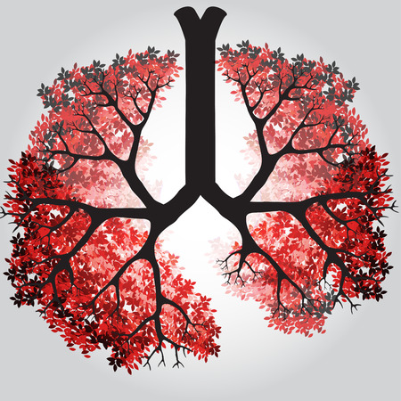 Tree Branches Like Lungs - Vector Illustrationのイラスト素材