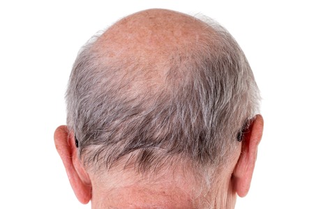 Back of the bald head of old man. Back view. Isolated on a white background.の写真素材