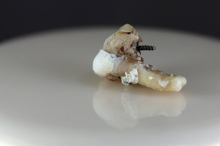 A damaged human tooth. The background is black and blurry. Close-up.