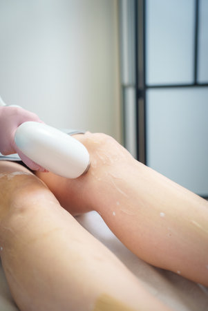 Professional Clinic Offers Laser Hair Removal for Smooth Legsの写真素材