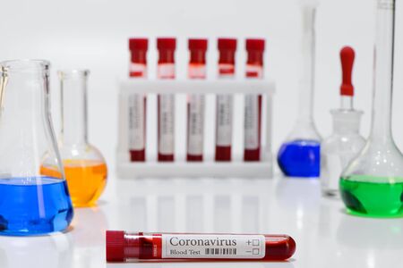 COVID-19 test and laboratory sample of blood testing for diagnosis coronavirus infectionの写真素材