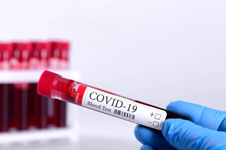 COVID-19 test and laboratory sample of blood testing for diagnosis coronavirus infection in the hands of the laboratory assistant isolated on white background and space for ads conceptの写真素材