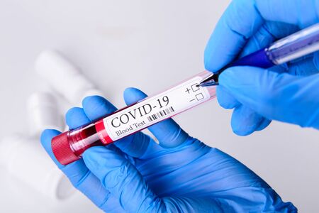 Covid-19 coronavirus disease blood test tube in hands epidemic concept background close-upの写真素材