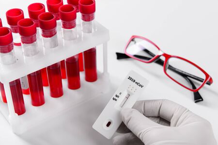 Rapid Covid-19 coronavirus strip test cassette for antibody or sars-cov-2 virus disease in hand and blood test tube epidemic concept background close-upの写真素材