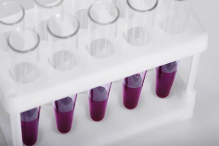 blood tubes in a medical laboratory science and research - nobody