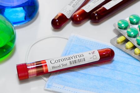 COVID-19 laboratory test tube and laboratory sample of blood testing for diagnosis coronavirus infection nobodyの写真素材