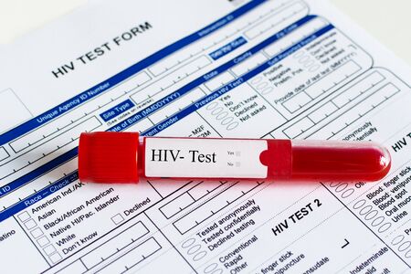 Red blood vial with blood sample over HIV test form background. Blood sample for HIV-Test checking.の写真素材