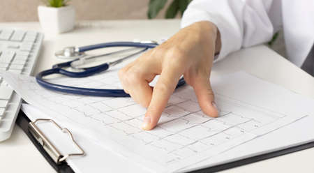 Close-up image of cardiologist checking cardiogram of patientの写真素材