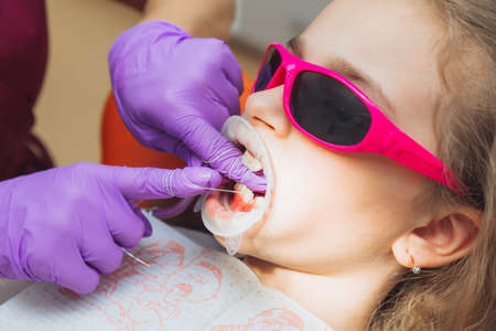 The dentist cleans the teeth of a little girl with dental floss. Photo of a patient with an open...