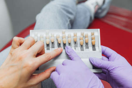 Selection of the correct tooth color for professional cosmetic whitening at the dentist. the doctor...