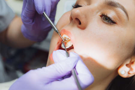 The dentist examines the teeth of a female patient, close-up. modern dentistry