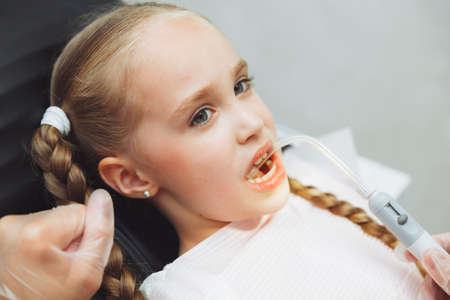 A dentist treats a little girl's teeth with dental equipment. Dental treatment in children....