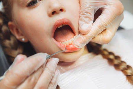 the dentist performs an examination procedure on a cute little girl. Little girl sitting in the dentist's officeの写真素材