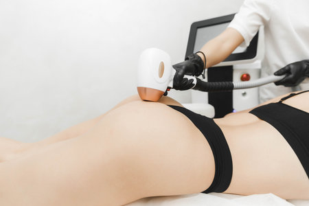 a young woman lies with her eyes closed and raises her hand up during the laser hair removal procedure. laser hair removal of the whole body.の写真素材