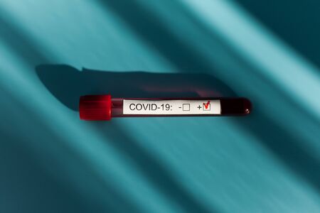 Blood test result tube In bright sunlight on the doctor desk for the new rapidly spreading Coronavirus, world pandemic.の写真素材