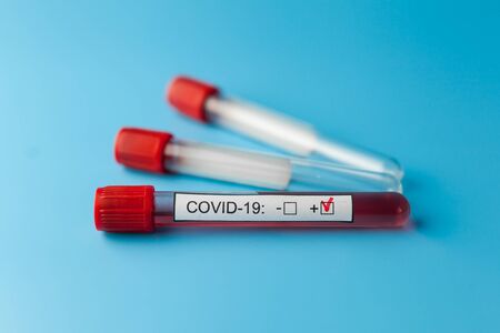 Blood test result tubes on the blue doctor desk for the new rapidly spreading Coronavirus, world pandemic.の写真素材