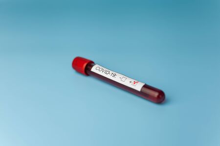 Blood test result tube on the blue doctor desk for the new rapidly spreading Coronavirus, world pandemic.の写真素材