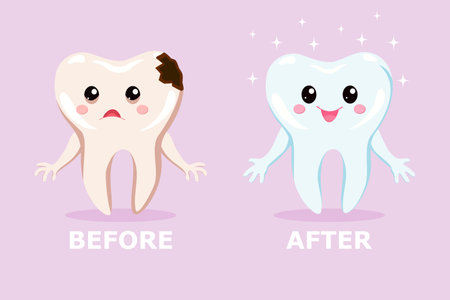 A sad tooth with caries and a healthy happy tooth before and after treatment. Dental treatment concept for pediatric dentistry. Cute dental cartoon characters.のイラスト素材