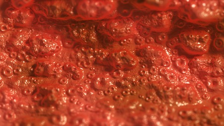 Not healthy mucous membrane or any internal organ. Medical 3d illustration or abstract background.の写真素材